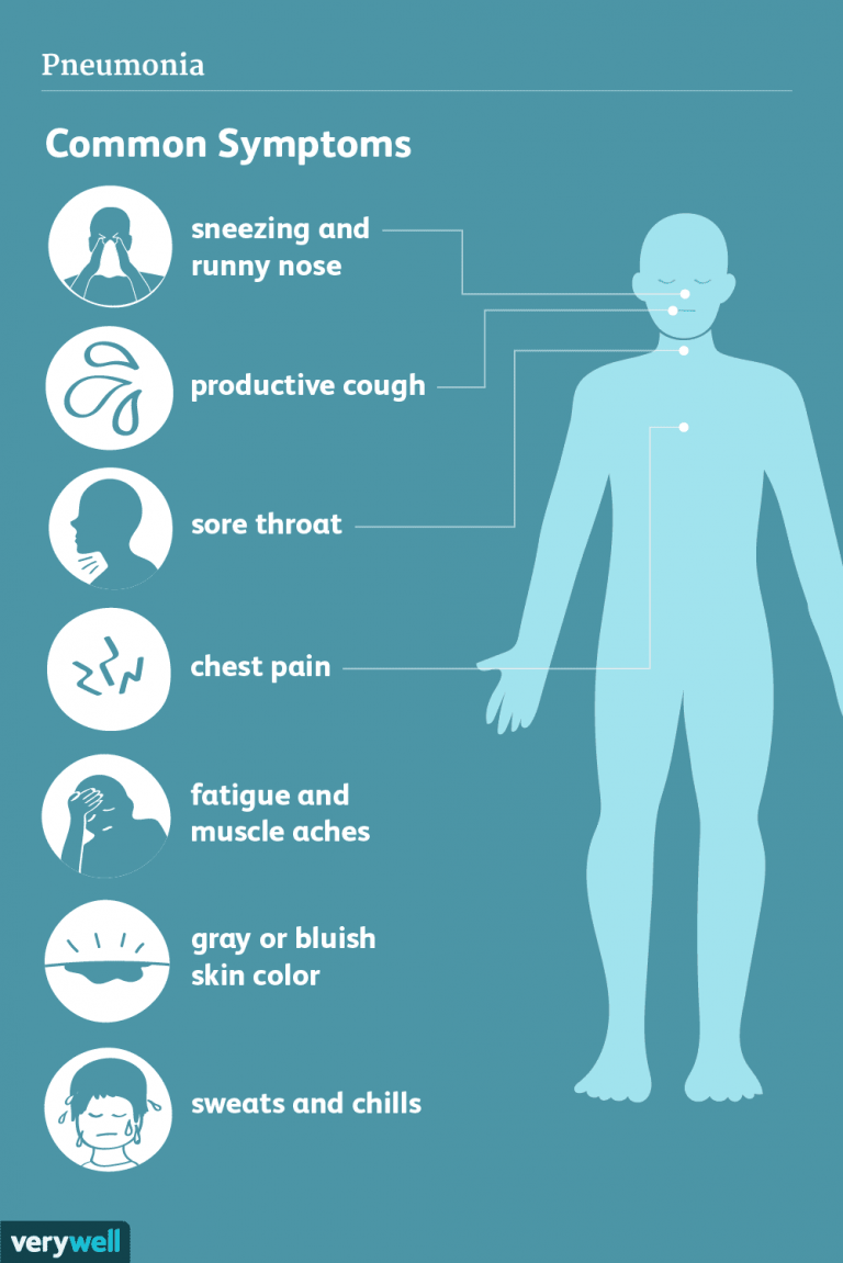 What Is Walking Pneumonia? [Signs, Symptoms, Causes, Treatment, FAQ]