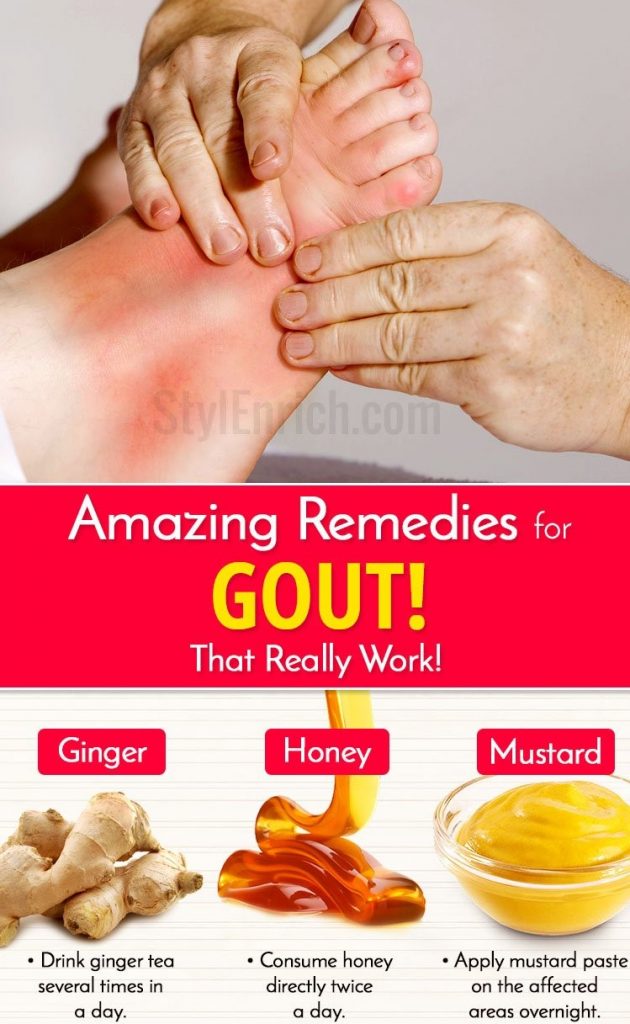 Foods to Avoid With Gout