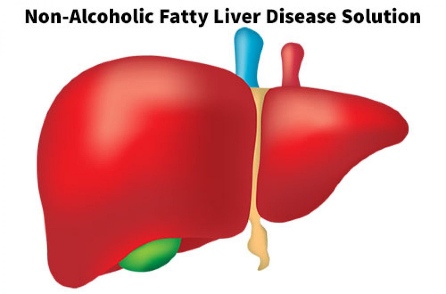 non-alcoholic-fatty-liver-disease-nafld-hunterdon-gastroenterology