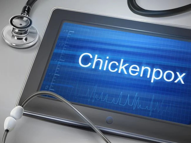 Chickenpox Vaccine Side Effects